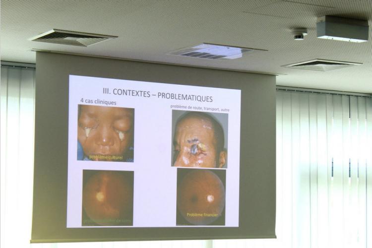 SGO : Un accent sur la prévention du glaucome et de la cataracte